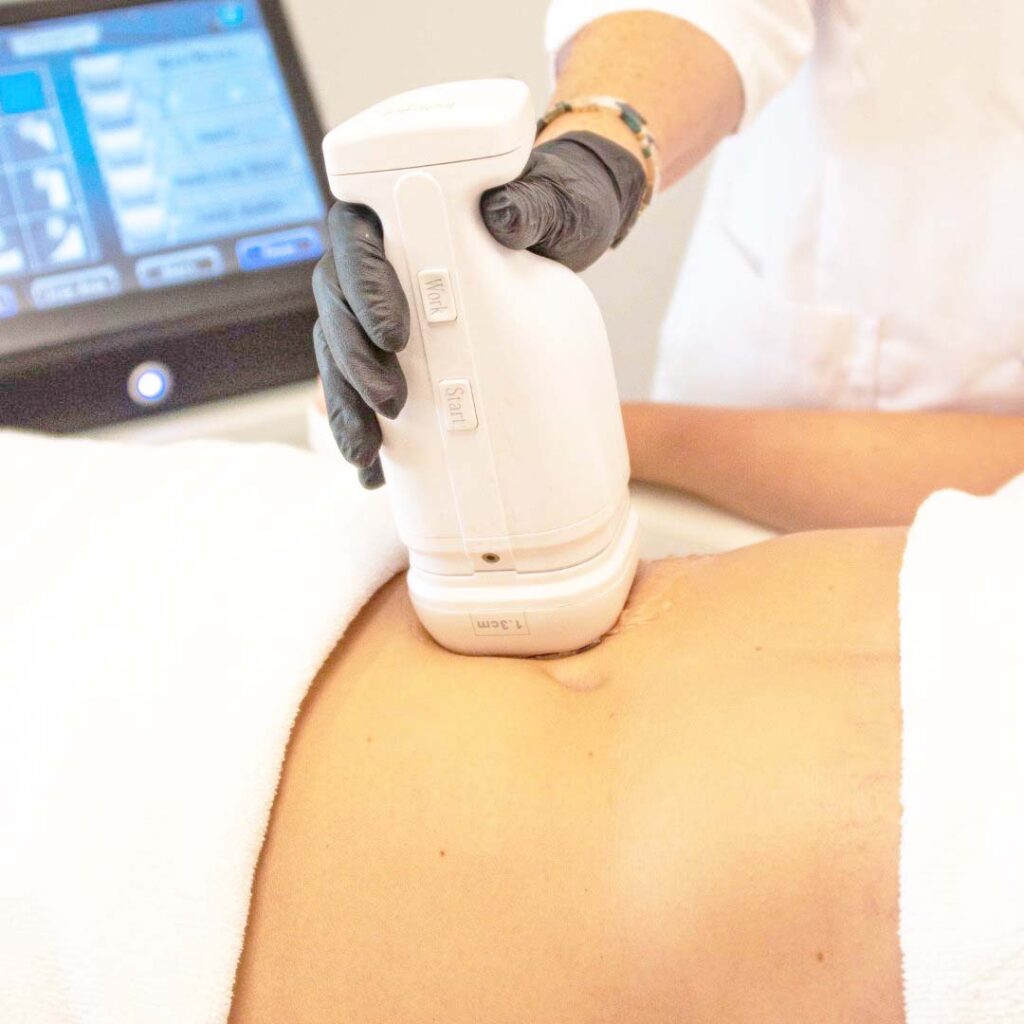 Tratamientos corporales en Blanes - Liposonix