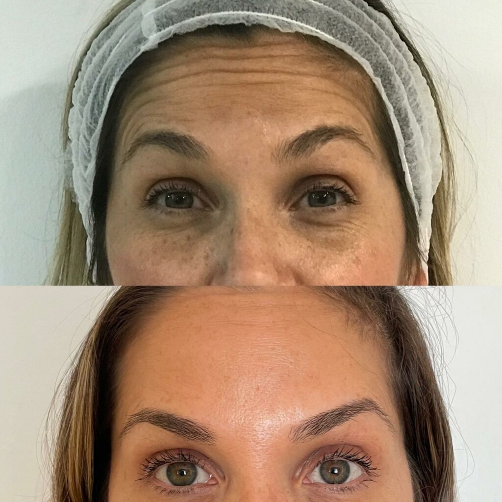 MEDICINA ESTÉTICA EN BLANES​