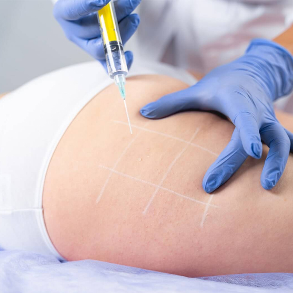 TRATAMIENTOS CORPORALES EN BLANES​ - mESOTERaPIA